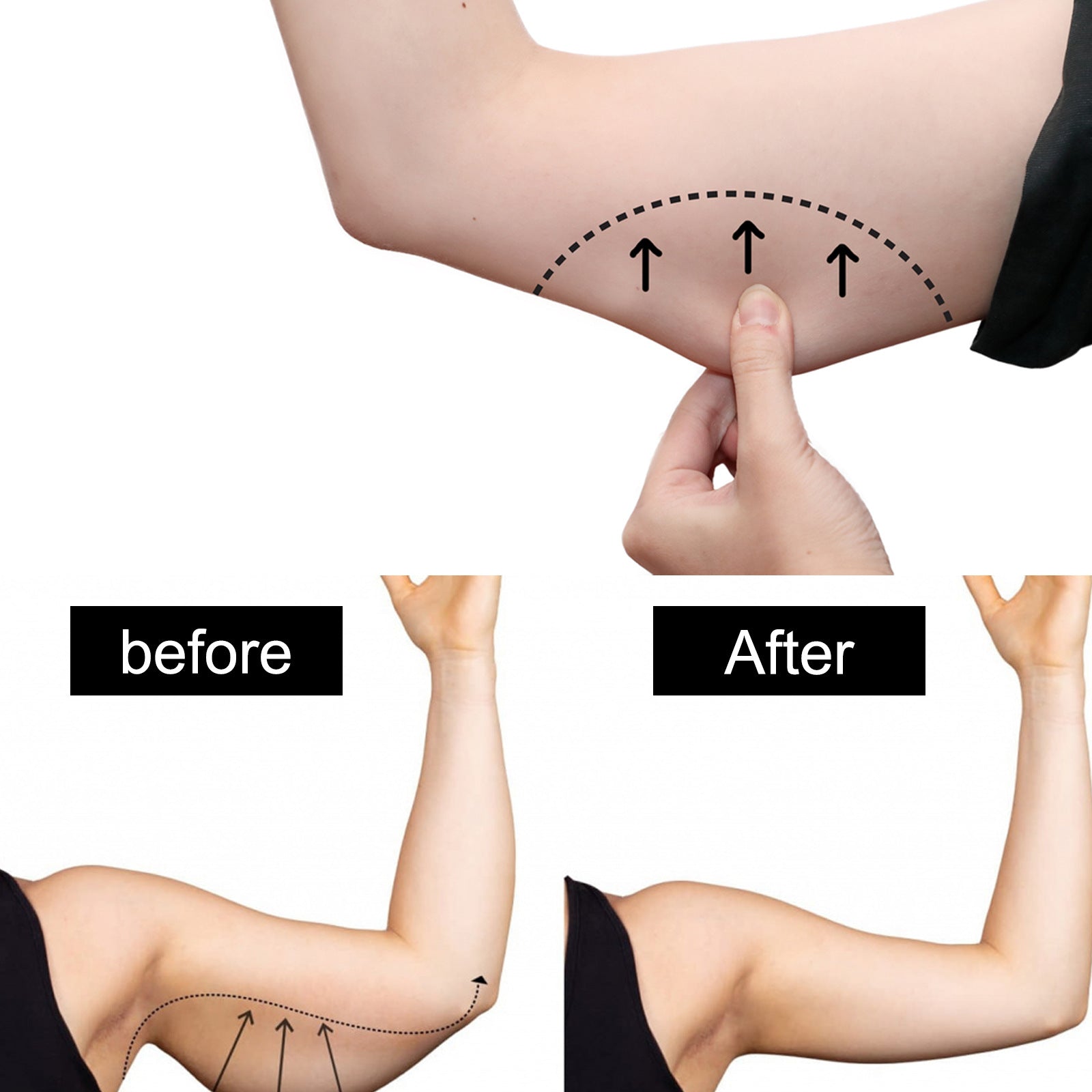 Thin Arm Patch – Herbal Weight Loss & Fat Burning Stickers (12 pcs) | Slimming & Cellulite Removal | لصقات تنحيف الأعشاب الطبيعية