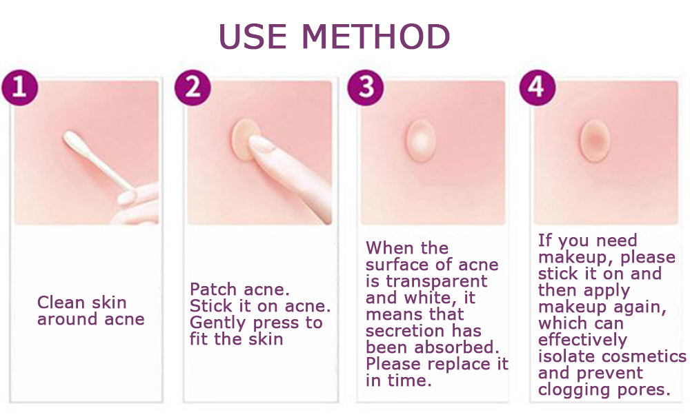 Yoxier Acne Patch – Invisible Spot Treatment Stickers (36 pcs) | Fast Acne Healing | لاصقات علاج حب الشباب غير مرئية