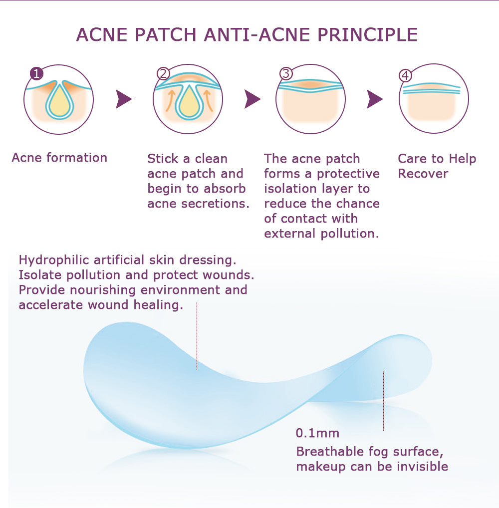 Yoxier Acne Patch – Invisible Spot Treatment Stickers (36 pcs) | Fast Acne Healing | لاصقات علاج حب الشباب غير مرئية
