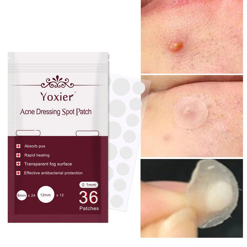 Yoxier Acne Patch – Invisible Spot Treatment Stickers (36 pcs) | Fast Acne Healing | لاصقات علاج حب الشباب غير مرئية