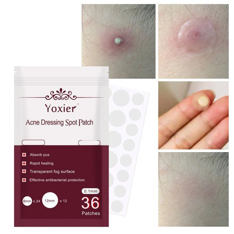 Yoxier Acne Patch – Invisible Spot Treatment Stickers (36 pcs) | Fast Acne Healing | لاصقات علاج حب الشباب غير مرئية